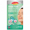 Schaebens Reine Haut Anti-Pickel-Patches Патчи против воспалений - 2